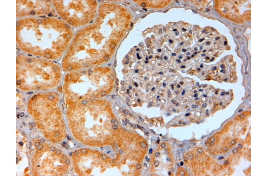 Immunohistochemistry - Anti-Adenosine A2b Receptor/ADORA2B Antibody (A84130) - Antibodies.com