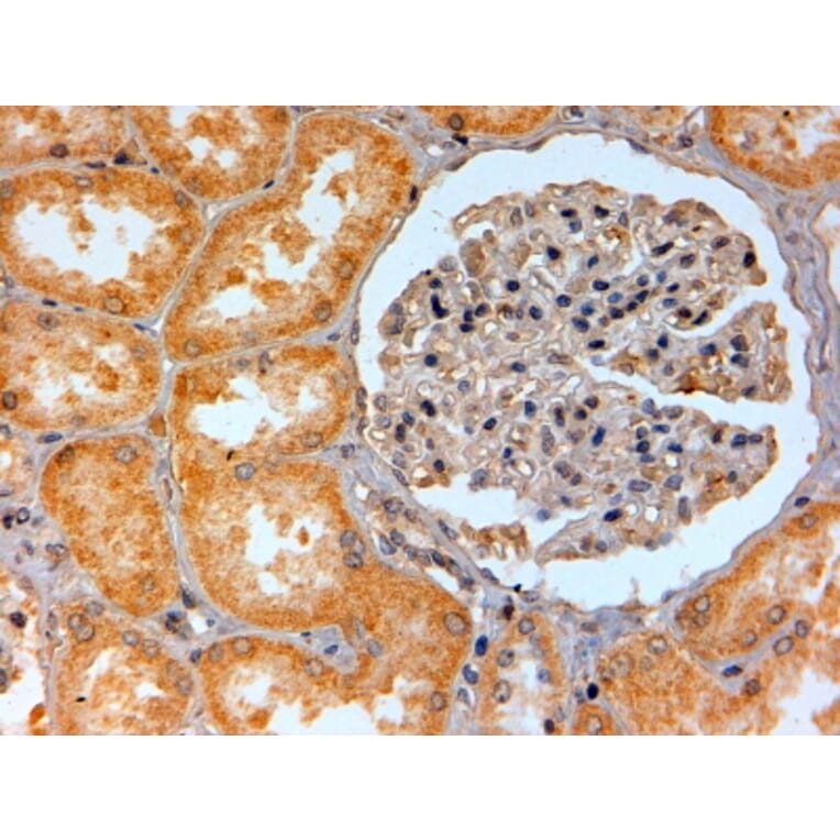 Immunohistochemistry - Anti-Adenosine A2b Receptor/ADORA2B Antibody (A84130) - Antibodies.com