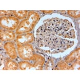 Immunohistochemistry - Anti-Adenosine A2b Receptor/ADORA2B Antibody (A84130) - Antibodies.com
