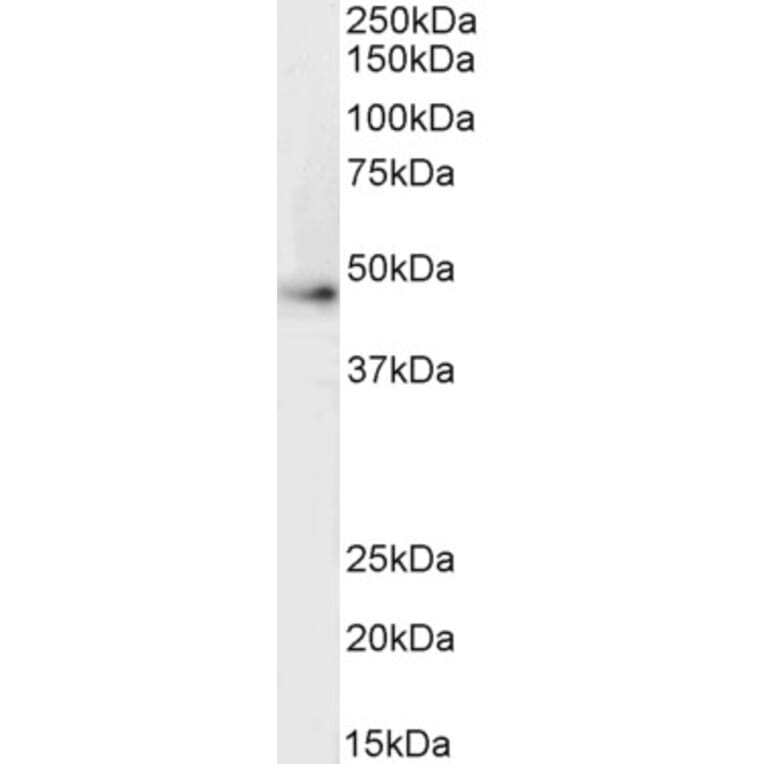 Western Blot - Anti-beta 2 Adrenergic Receptor Antibody (A84131) - Antibodies.com