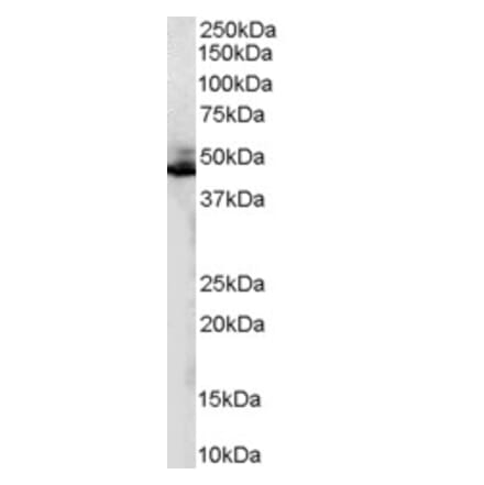 Western Blot - Anti-ADRB2 Antibody (A84131) - Antibodies.com