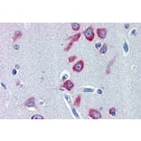 Immunohistochemistry - Anti-PCK1/PEPC Antibody (A84132) - Antibodies.com