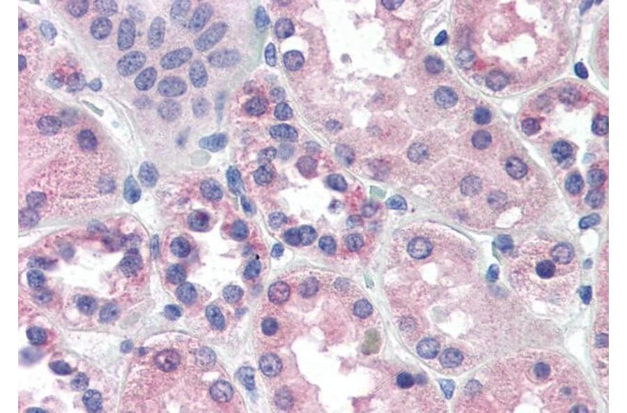 Immunohistochemistry - Anti-PCK1/PEPC Antibody (A84132) - Antibodies.com