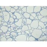 Immunohistochemistry - Anti-ENPP1/PC1 Antibody (A84135) - Antibodies.com