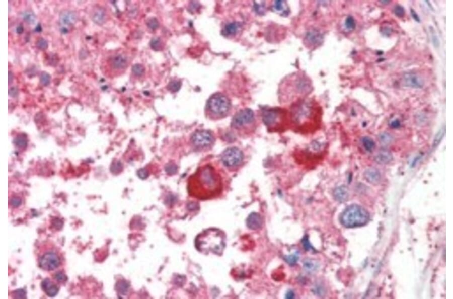Immunohistochemistry - Anti-PCID1 Antibody (A84137) - Antibodies.com