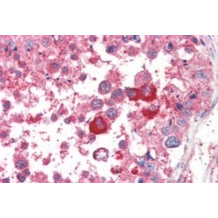 Immunohistochemistry - Anti-PCID1 Antibody (A84137) - Antibodies.com