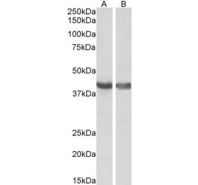 Western Blot - Anti-HEXIM1 Antibody (A84138) - Antibodies.com