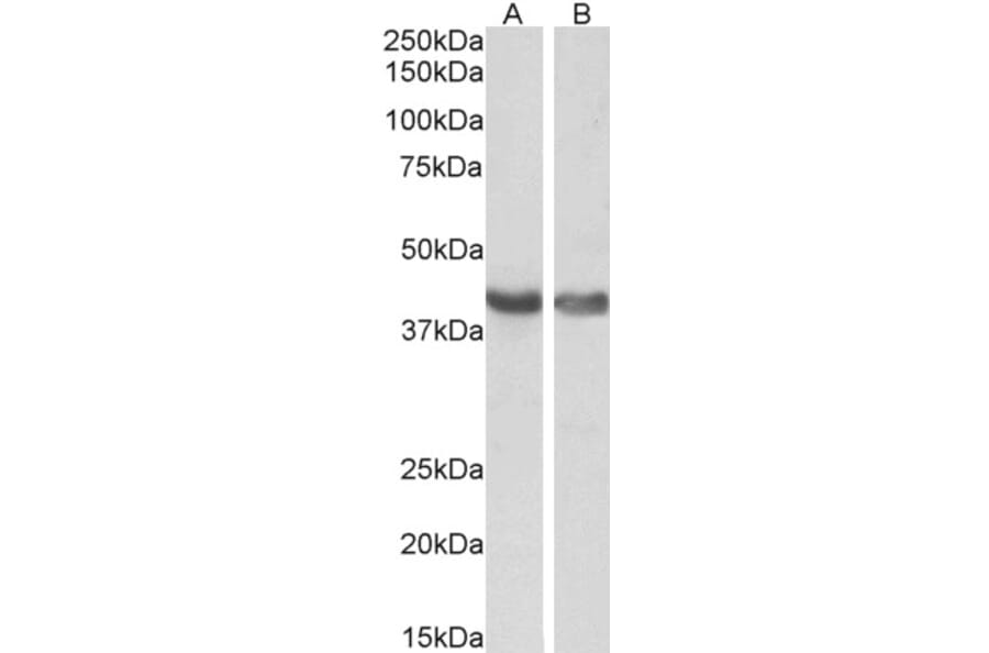 Western Blot - Anti-HEXIM1 Antibody (A84138) - Antibodies.com