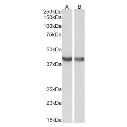 Western Blot - Anti-HEXIM1 Antibody (A84138) - Antibodies.com