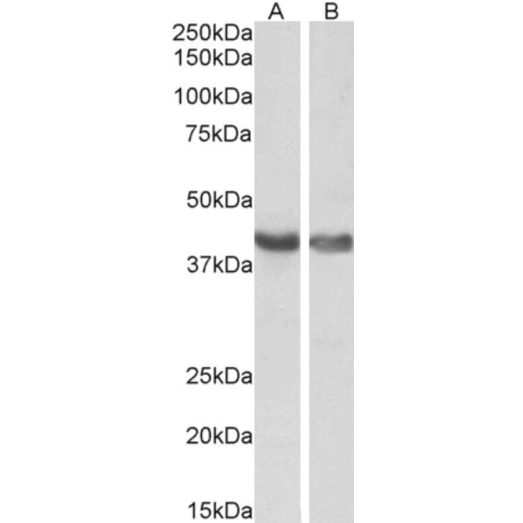 Western Blot - Anti-HEXIM1 Antibody (A84138) - Antibodies.com