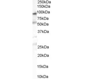 Western Blot - Anti-OSBPL10 Antibody (A84140) - Antibodies.com