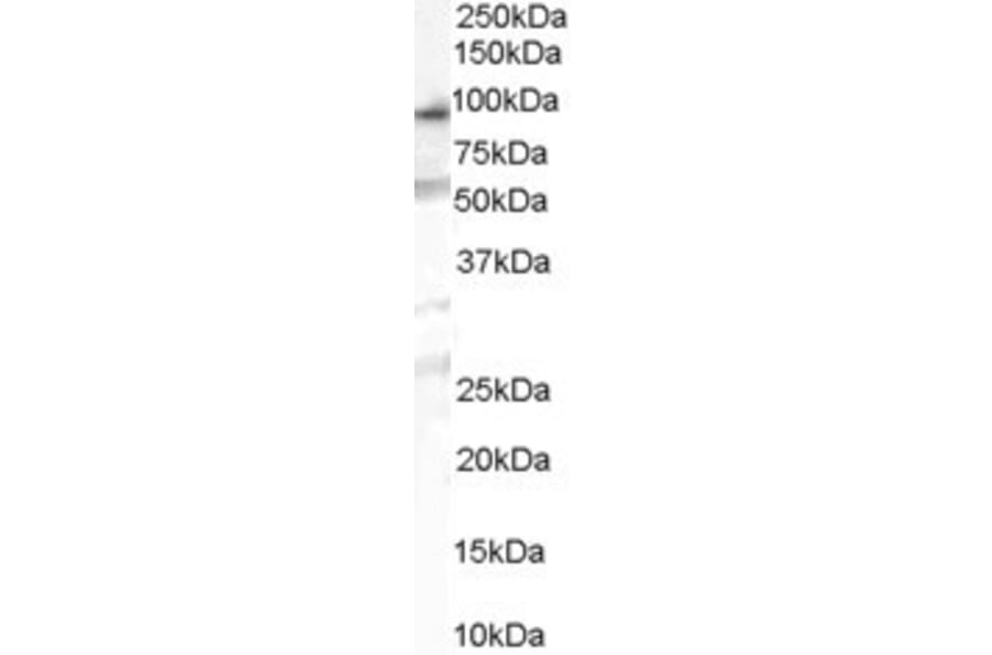 Western Blot - Anti-OSBPL10 Antibody (A84140) - Antibodies.com