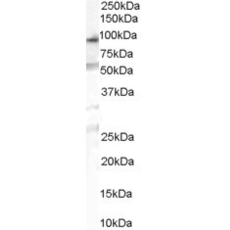 Western Blot - Anti-OSBPL10 Antibody (A84140) - Antibodies.com