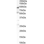 Western Blot - Anti-OSBPL10 Antibody (A84140) - Antibodies.com