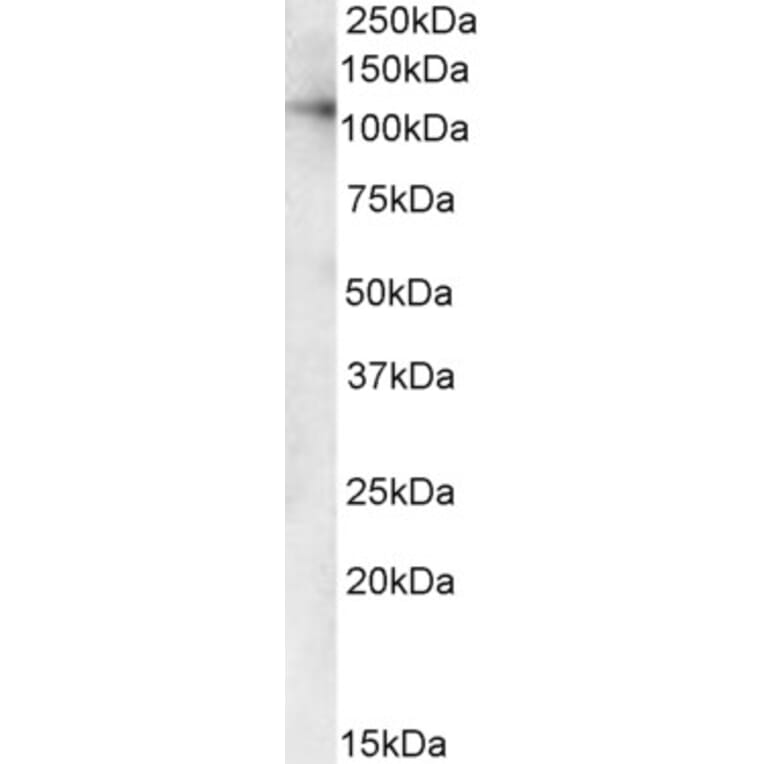 Western Blot - Anti-USO1 Antibody (A84141) - Antibodies.com