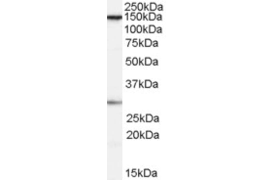 Western Blot - Anti-SUPT16H Antibody (A84143) - Antibodies.com