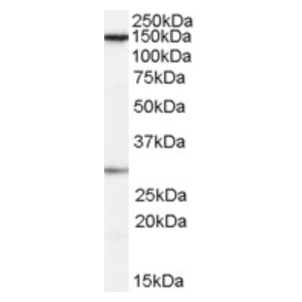 Western Blot - Anti-SUPT16H Antibody (A84143) - Antibodies.com