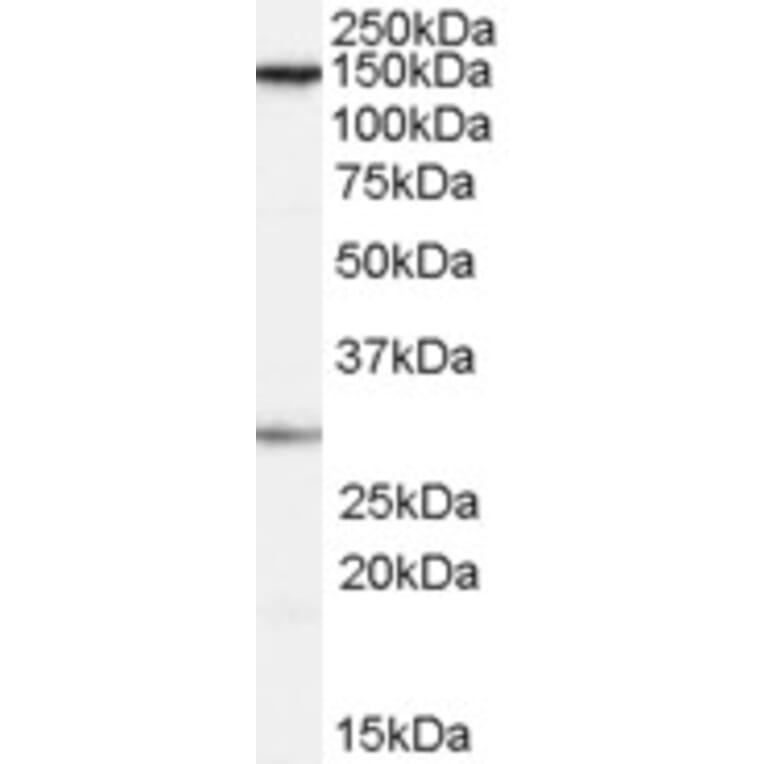 Western Blot - Anti-SUPT16H Antibody (A84143) - Antibodies.com