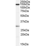 Western Blot - Anti-SUPT16H Antibody (A84143) - Antibodies.com