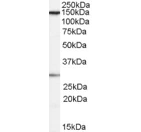 Western Blot - Anti-SUPT16H Antibody (A84143) - Antibodies.com