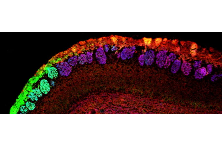 Immunohistochemistry - Anti-NCAM2 Antibody (A84144) - Antibodies.com