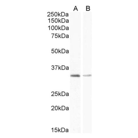 Western Blot - Anti-UCP1 Antibody (A84145) - Antibodies.com