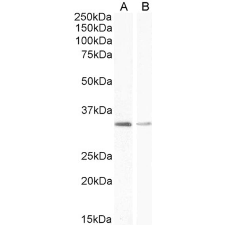 Western Blot - Anti-UCP1 Antibody (A84145) - Antibodies.com