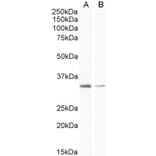 Western Blot - Anti-UCP1 Antibody (A84145) - Antibodies.com