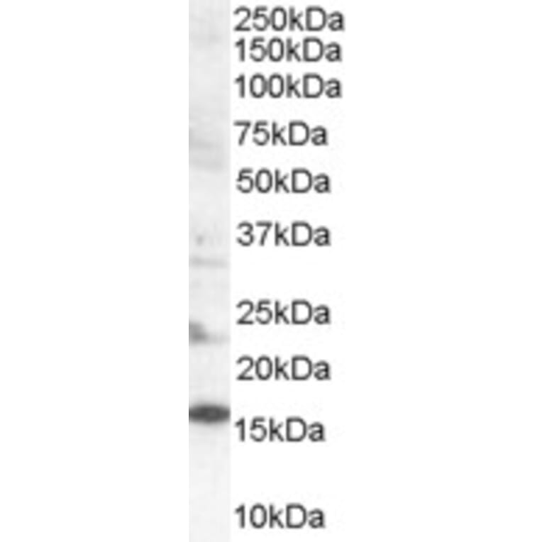 Western Blot - Anti-SH2D1A Antibody (A84147) - Antibodies.com