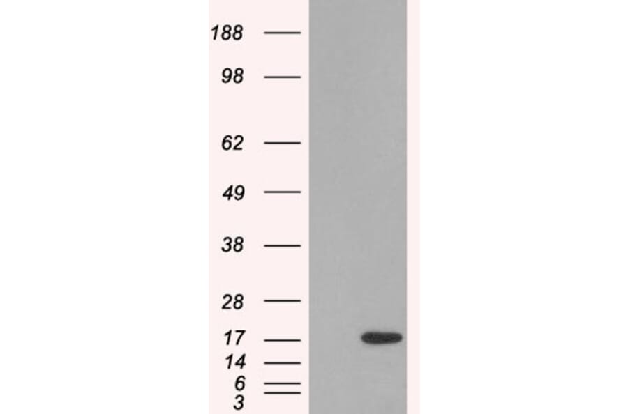 Western Blot - Anti-SH2D1A Antibody (A84147) - Antibodies.com