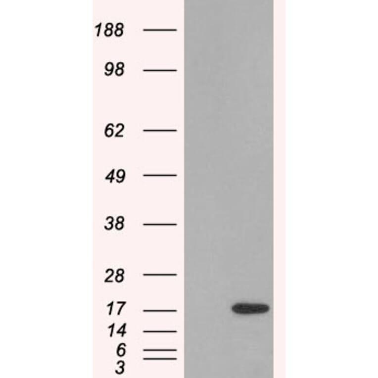 Western Blot - Anti-SH2D1A Antibody (A84147) - Antibodies.com