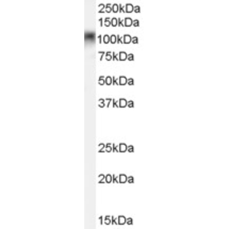Western Blot - Anti-B MyB Antibody (A84148) - Antibodies.com