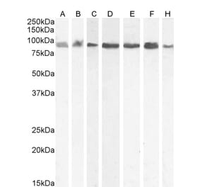 Western Blot - Anti-KPNB1 Antibody (A84149) - Antibodies.com