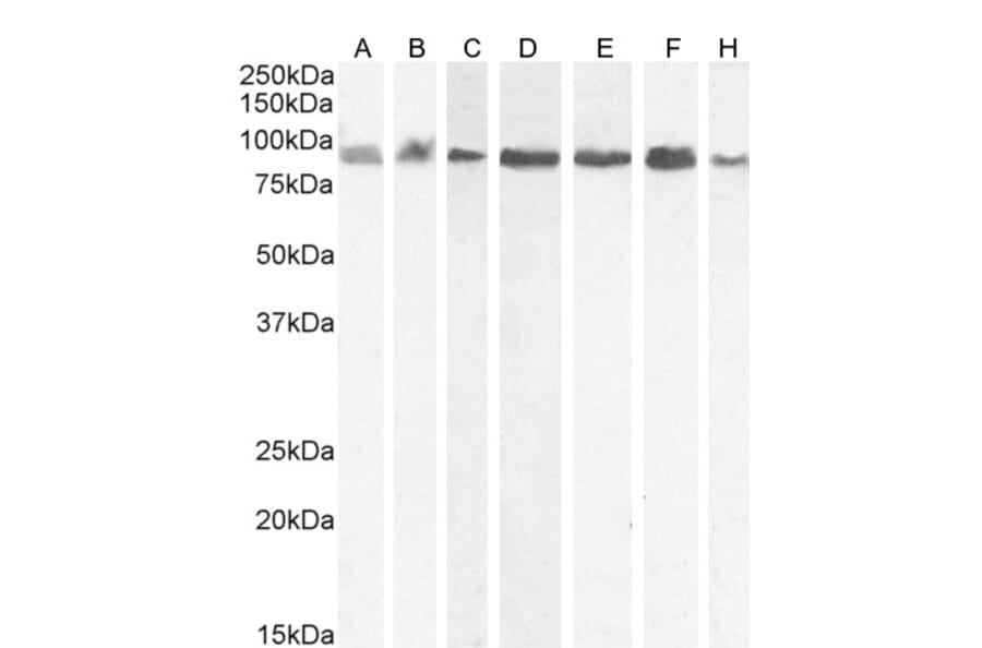 Western Blot - Anti-KPNB1 Antibody (A84149) - Antibodies.com