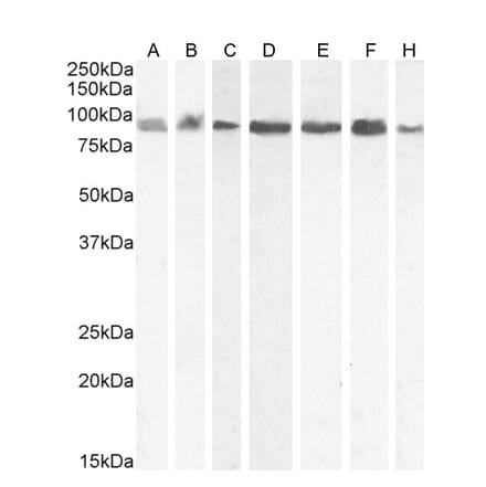 Western Blot - Anti-KPNB1 Antibody (A84149) - Antibodies.com