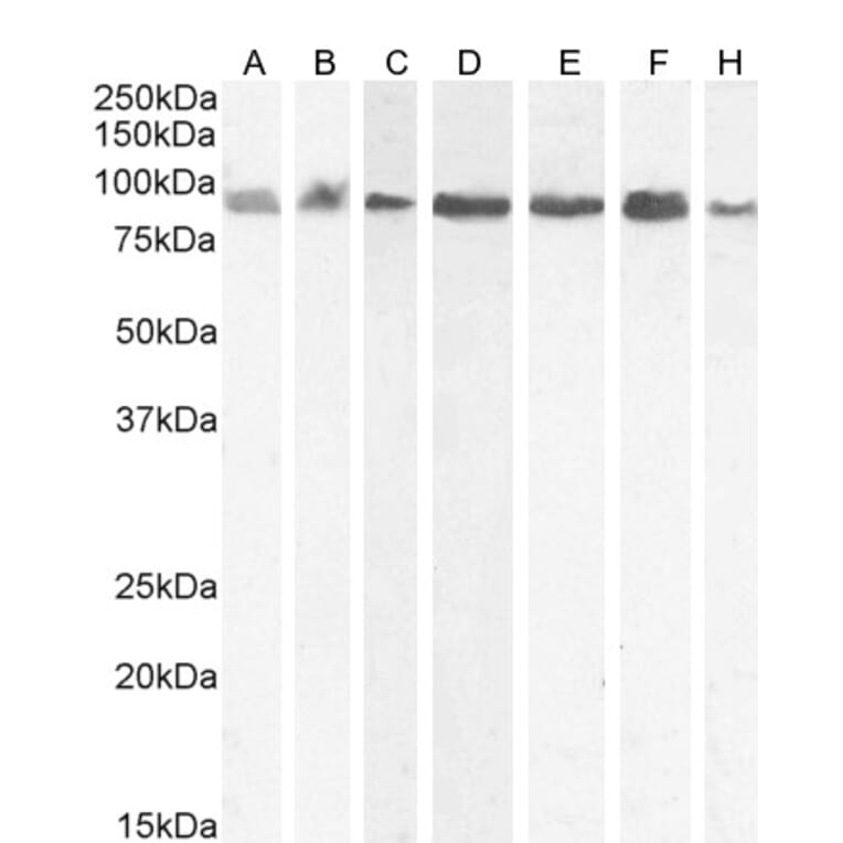 Western Blot - Anti-KPNB1 Antibody (A84149) - Antibodies.com
