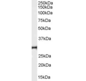 Western Blot - Anti-HVEM Antibody (A84150) - Antibodies.com