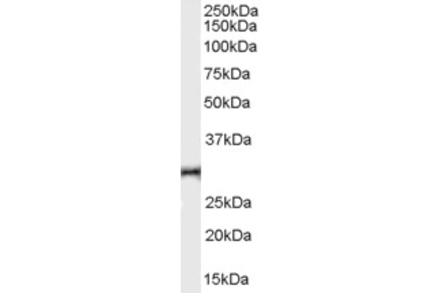 Western Blot - Anti-HVEM Antibody (A84150) - Antibodies.com