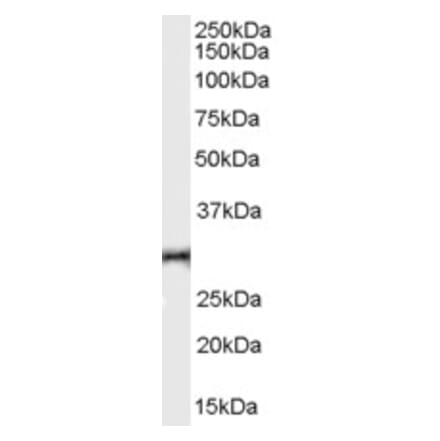 Western Blot - Anti-HVEM Antibody (A84150) - Antibodies.com