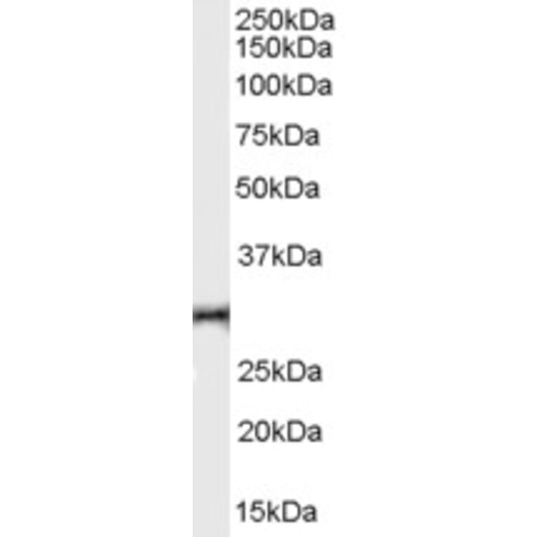 Western Blot - Anti-HVEM Antibody (A84150) - Antibodies.com