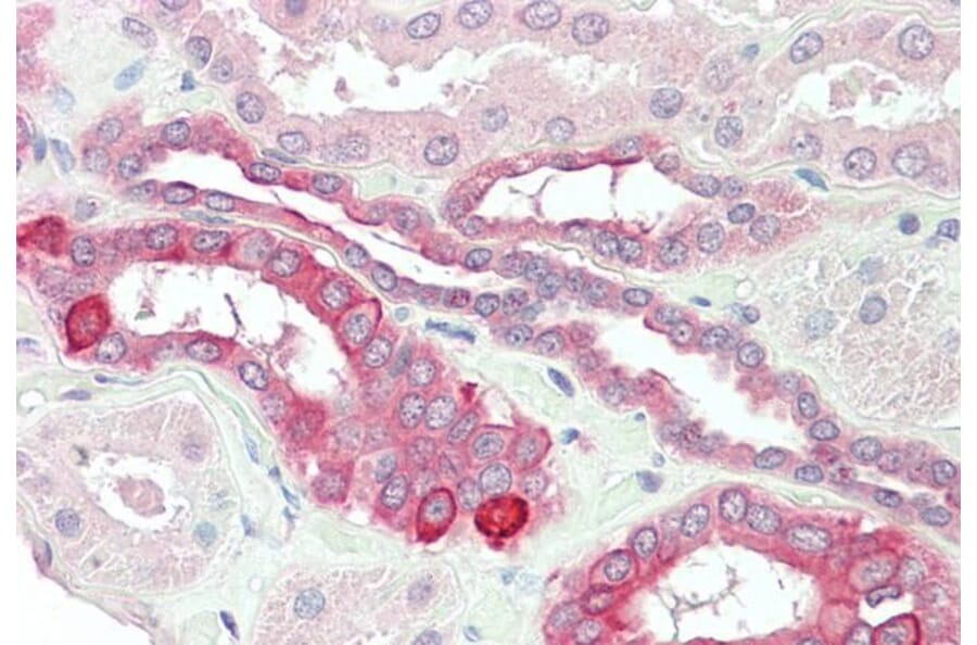 Immunohistochemistry - Anti-HVEM Antibody (A84150) - Antibodies.com