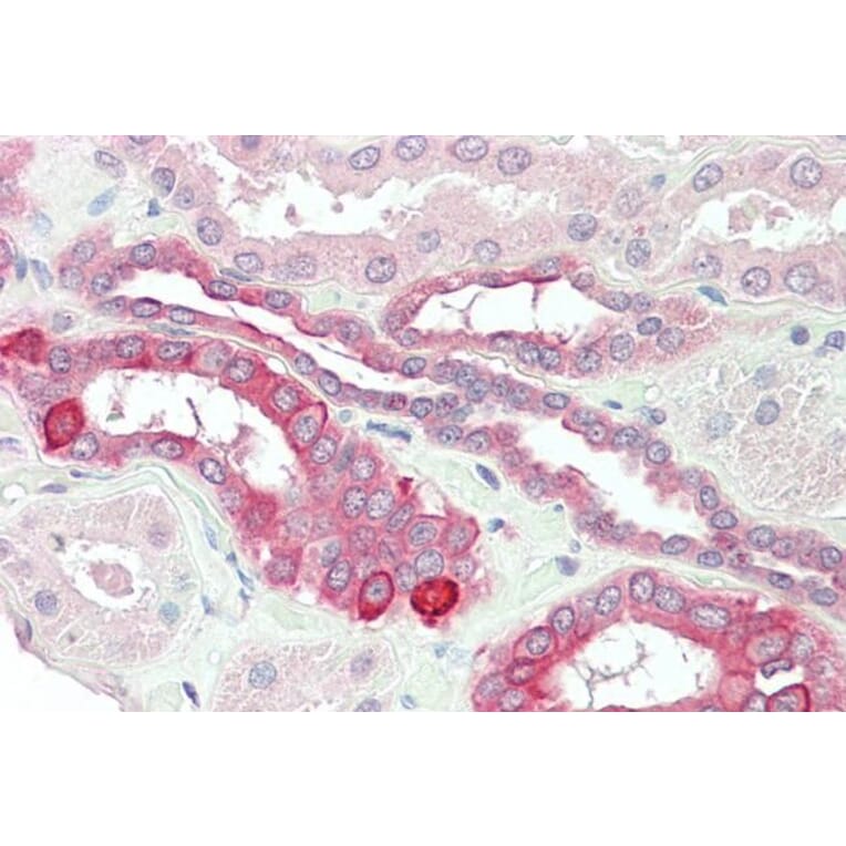 Immunohistochemistry - Anti-HVEM Antibody (A84150) - Antibodies.com