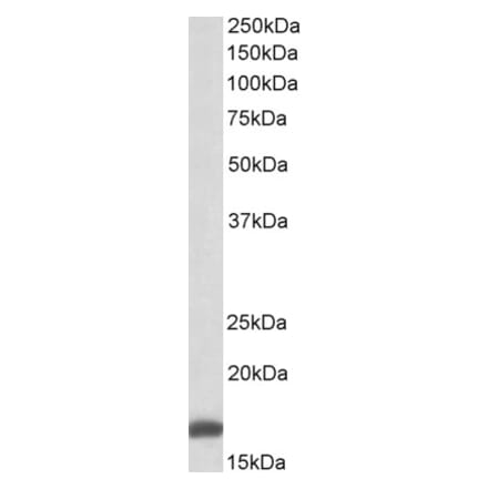 Western Blot - Anti-RPS19 Antibody (A84151) - Antibodies.com