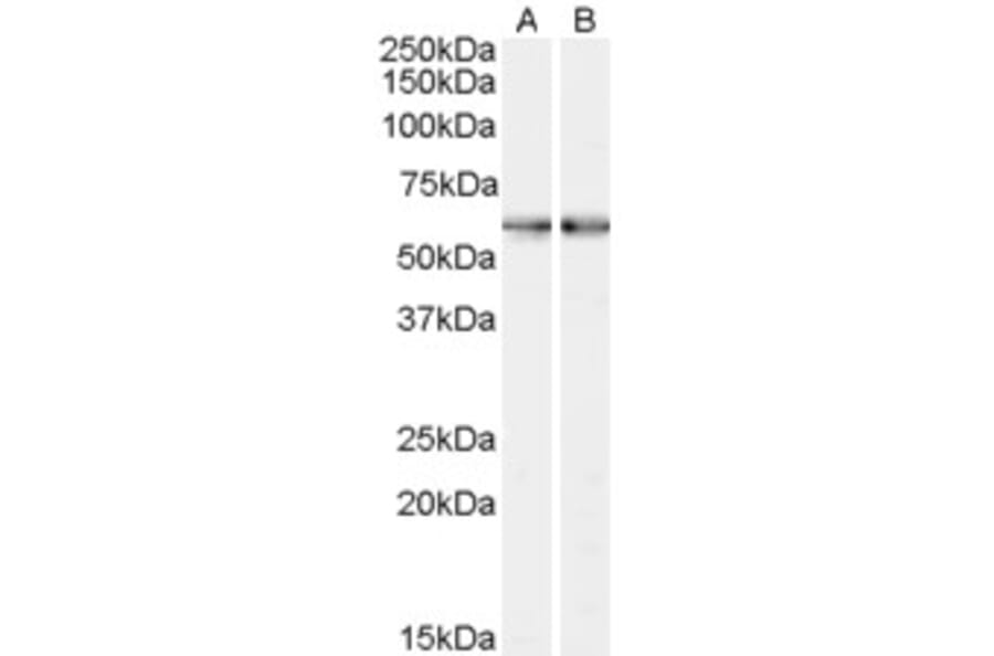 Western Blot - Anti-SMO Antibody (A84153) - Antibodies.com