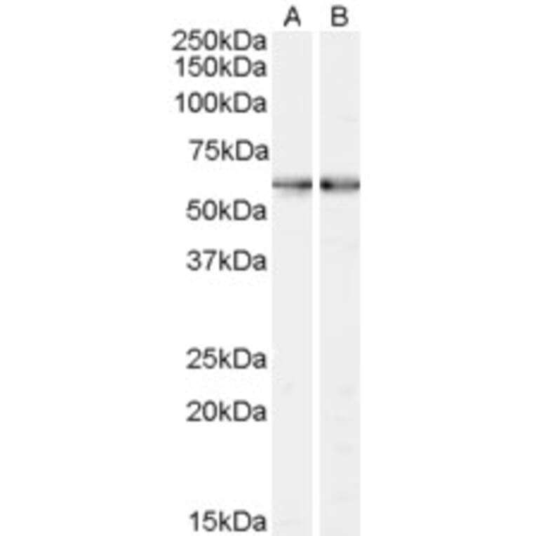 Western Blot - Anti-SMO Antibody (A84153) - Antibodies.com