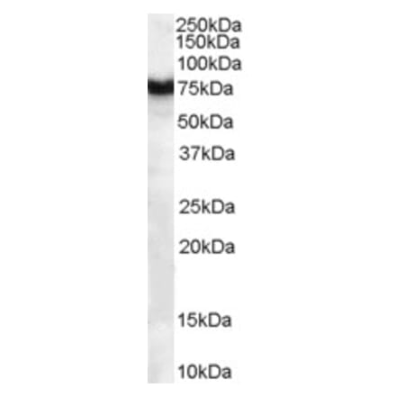 Western Blot - Anti-Frizzled 8 Antibody (A84154) - Antibodies.com