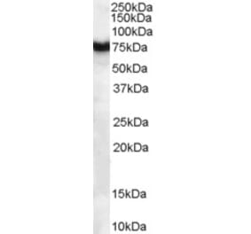 Western Blot - Anti-FZD8 Antibody (A84154) - Antibodies.com