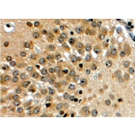 Immunohistochemistry - Anti-NOTCH3 Antibody (A84155) - Antibodies.com