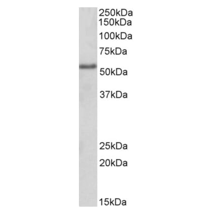 Western Blot - Anti-FOXC1 Antibody (A84156) - Antibodies.com