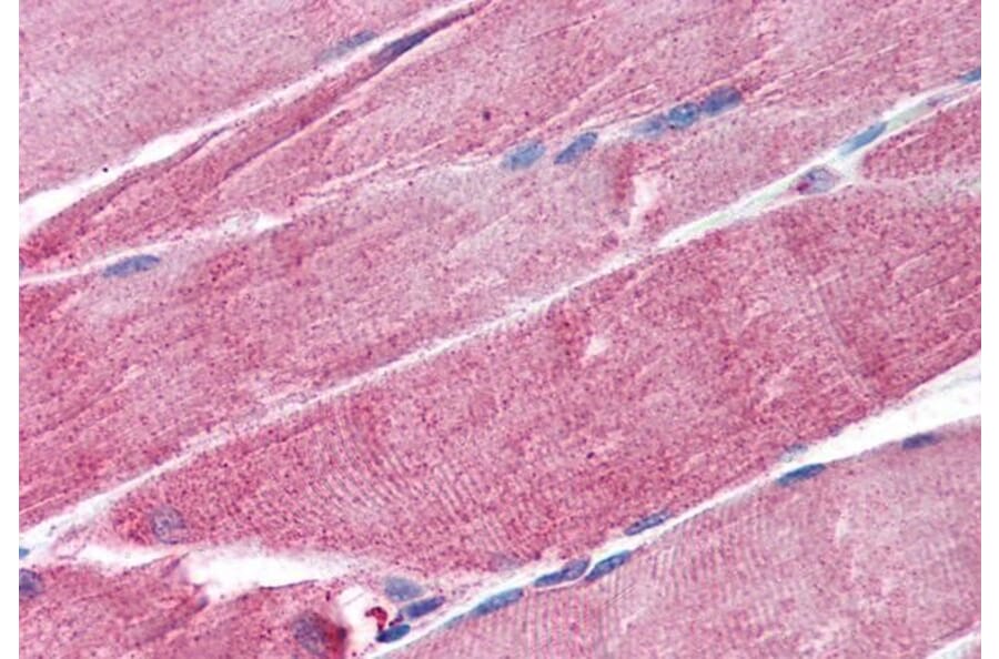 Immunohistochemistry - Anti-MURF1 Antibody (A84157) - Antibodies.com